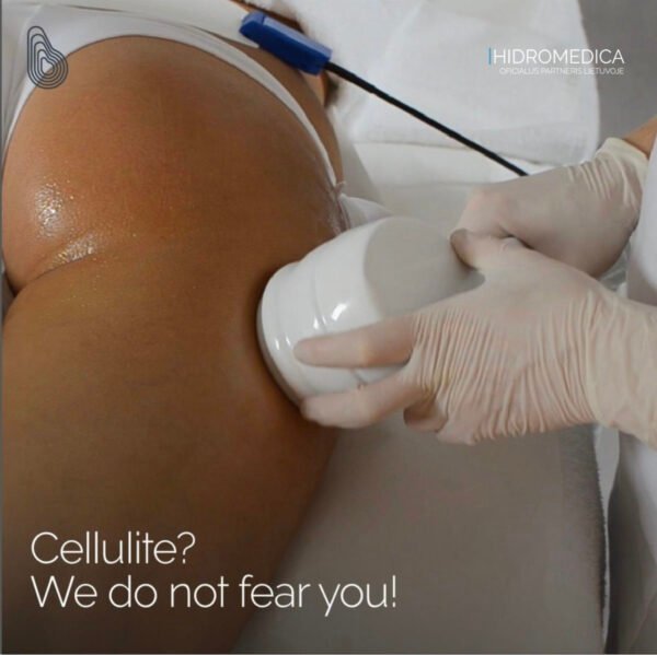 Multifunkcinis aparatas veidui ir kūnui „Coaxmed” (RF, kavitacija, vakuumas, lazeris, kriolipolizė)