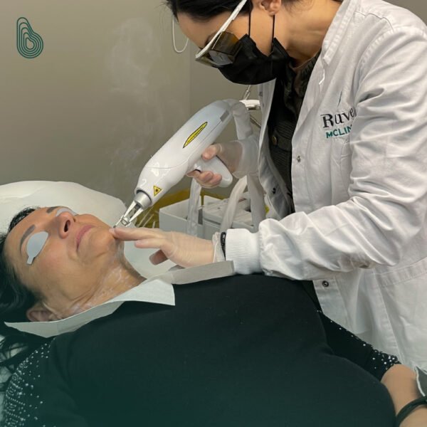 XLASE PLUS – multifunkcinė lazerinė platforma (Aleksandrito ir diodo lazeris viename, ND:YAG, QS ND:YAG, Er:YAG, CPL)