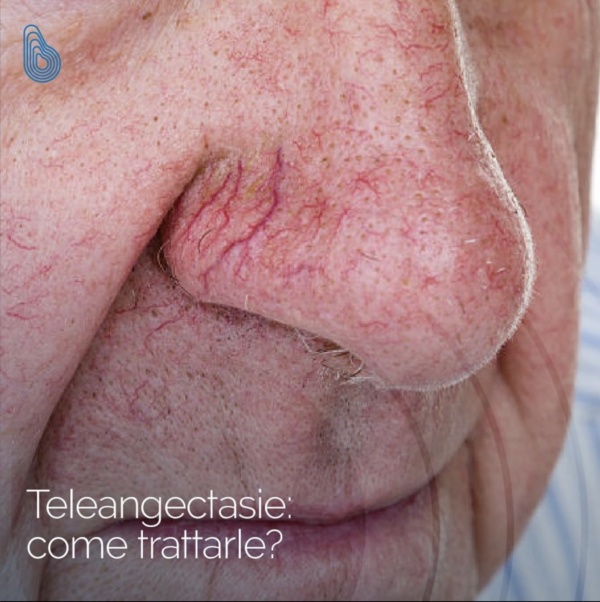 „Intraject” – plaukų ir odos biostimuliacijos ir biorevitalizacijos procedūroms