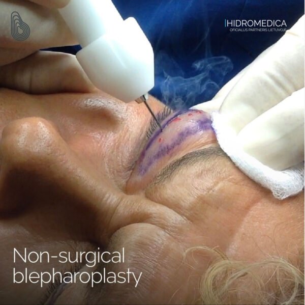 „Intraject” – plaukų ir odos biostimuliacijos ir biorevitalizacijos procedūroms