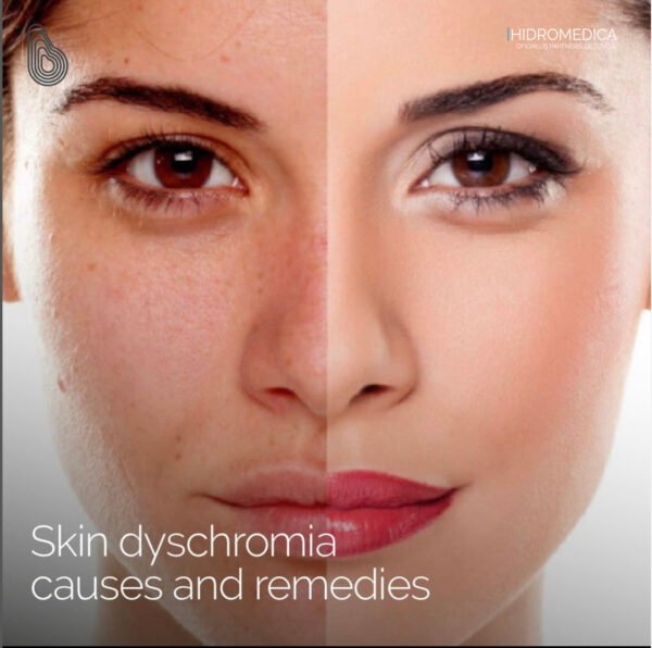 XLASE PLUS – multifunkcinė lazerinė platforma (Aleksandrito ir diodo lazeris viename, ND:YAG, QS ND:YAG, Er:YAG, CPL)