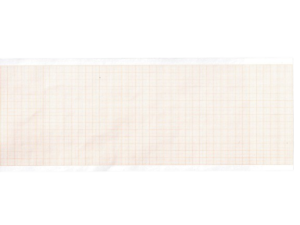 EKG terminis popierius 210 mm x 30 m, ritinėlis
