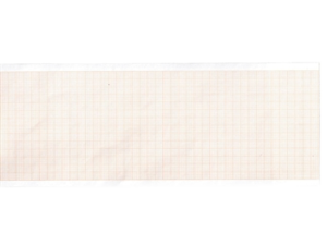 EKG terminis popierius 210×30 mm x m ritinėlis