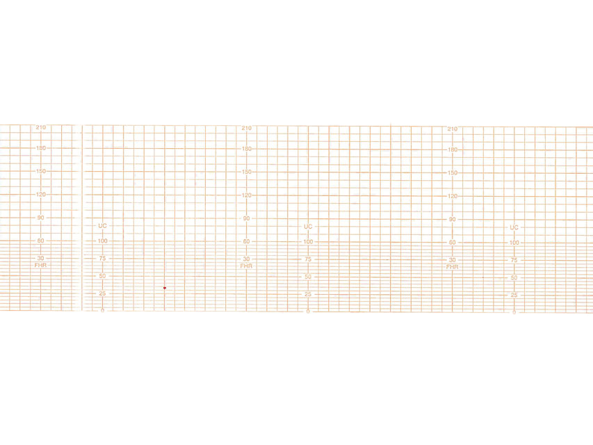 Z-Fold vaisiaus monitoriaus popierius 112×100 mm, 1 vnt.