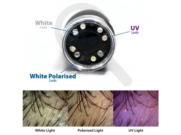 Skaitmeninis dermatoskopas „MIC -fi”