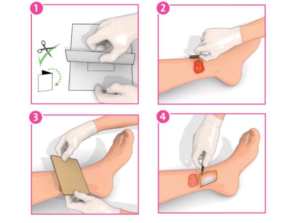 INADINE™ PVP-I nelipnus jodo tvarstis 9,5 x 9,5 cm, 1 vnt