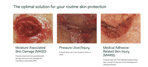 3M™ Cavilon™ apsauginė plėvele su aplikatoriumi, 1 ml