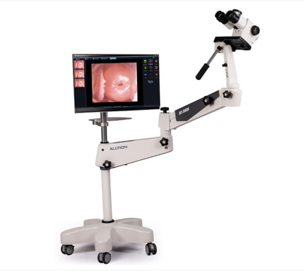 Kolposkopas „Alltion AC-5000”
