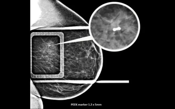 Naviko žymėjimo adata, 1 vnt.